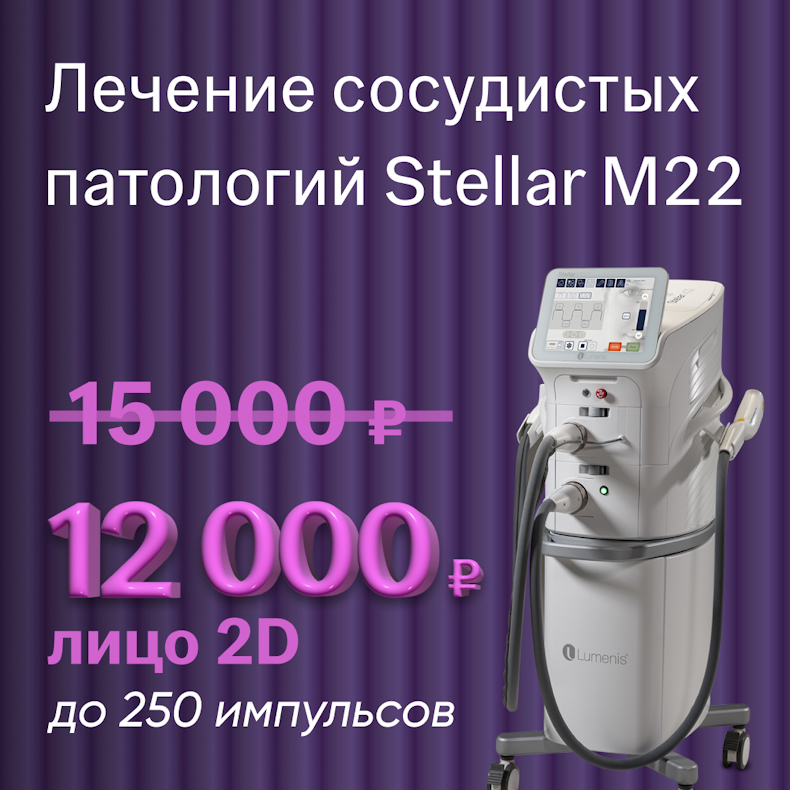 Лечение сосудистых патологий Stellar M22