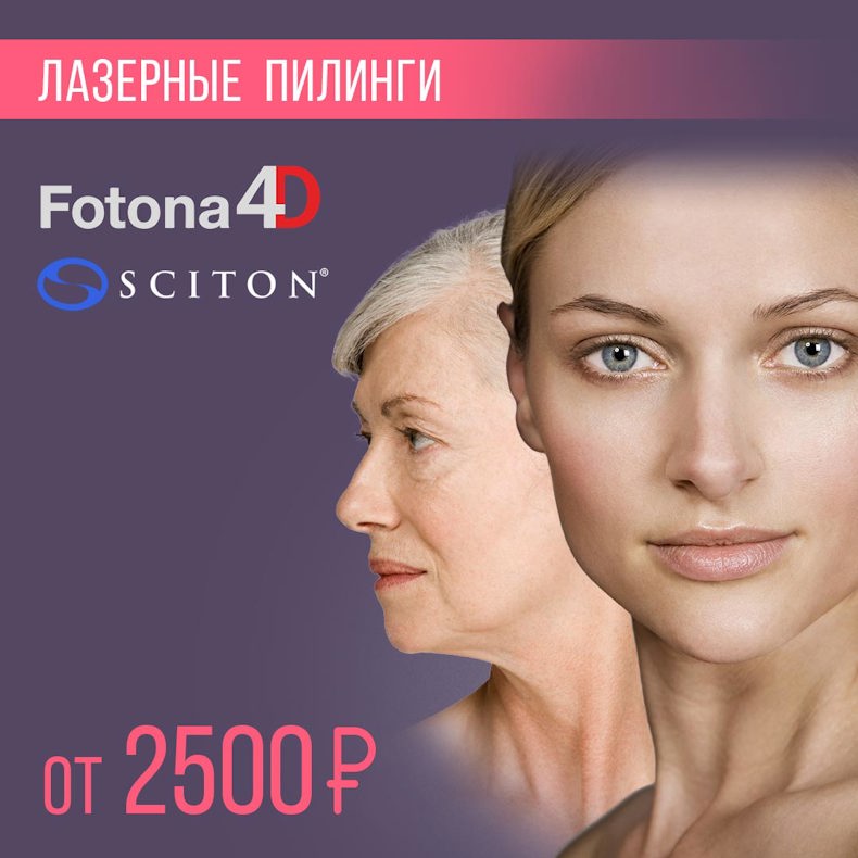 Лазерный пилинг