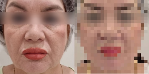 Это не фотошоп: магия поэтапного омоложения лица