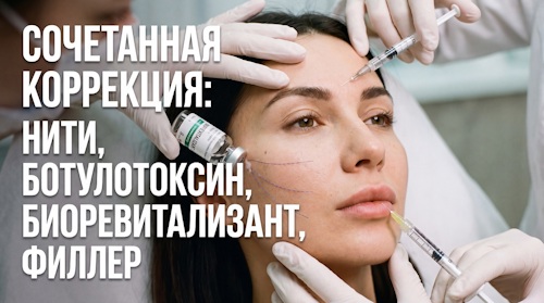 Сочетанная коррекция лица: синергия нитей, ботокса, филлеров и биоревитализации