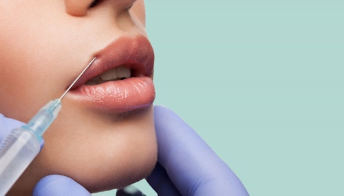 Увеличение губ гиалуроновой кислотой - что нужно знать о методе коррекции губ
