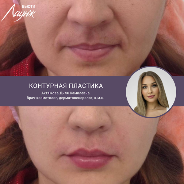 Ахтямова Диля Камилевна