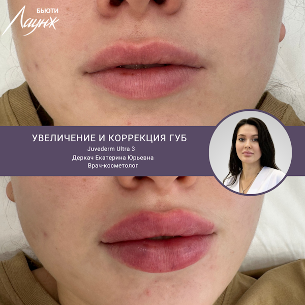 Деркач Екатерина Юрьевна