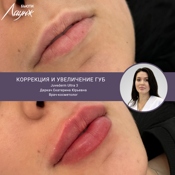 Деркач Екатерина Юрьевна