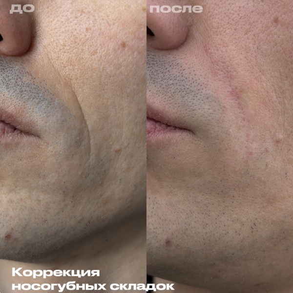 Филимонова Анна Александровна