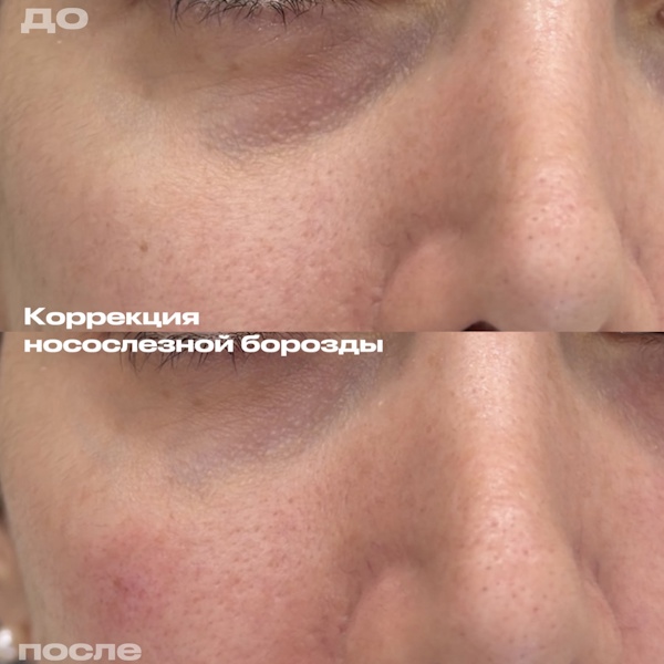 Филимонова Анна Александровна