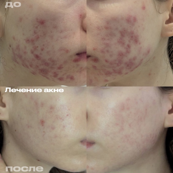 Филимонова Анна Александровна