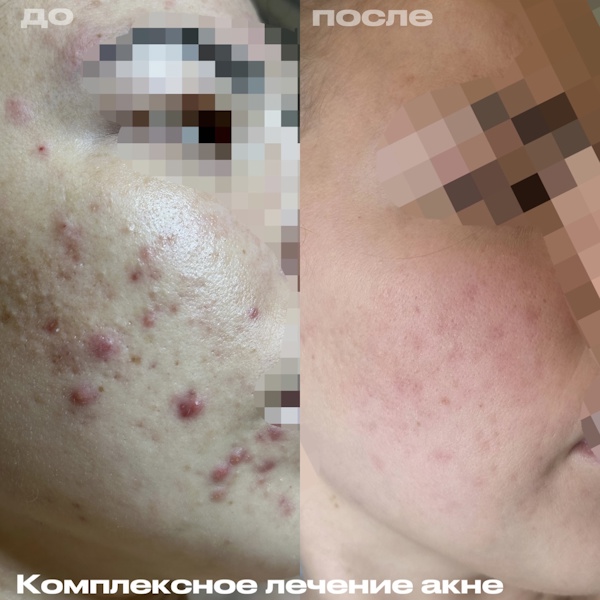 Филимонова Анна Александровна