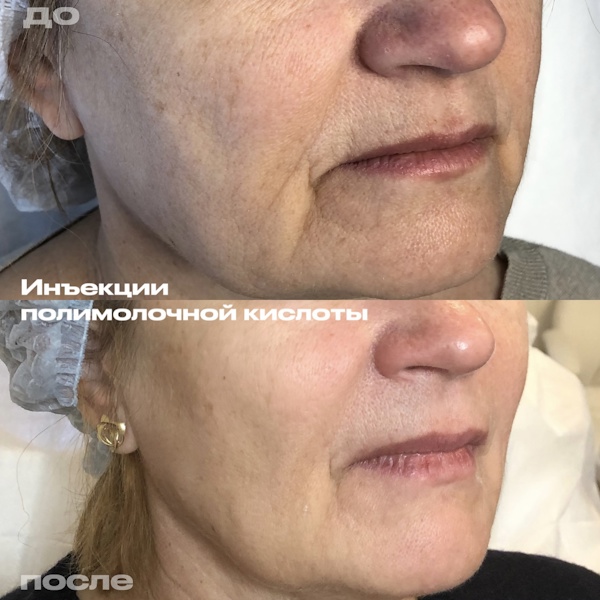 Филимонова Анна Александровна