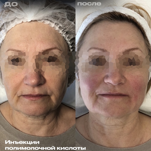 Филимонова Анна Александровна