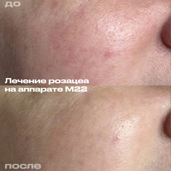 Филимонова Анна Александровна