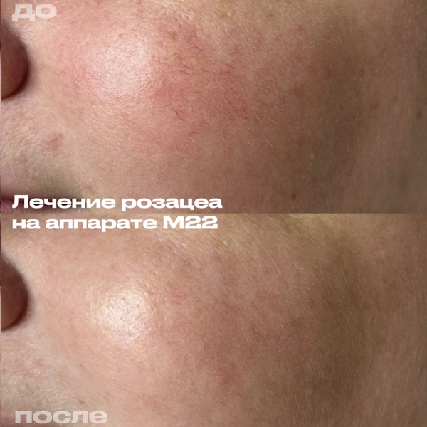 Филимонова Анна Александровна