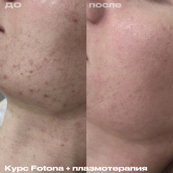 Калуцких Анна Владимировна