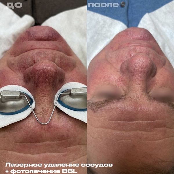 Калуцких Анна Владимировна