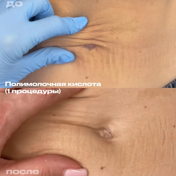 Калуцких Анна Владимировна