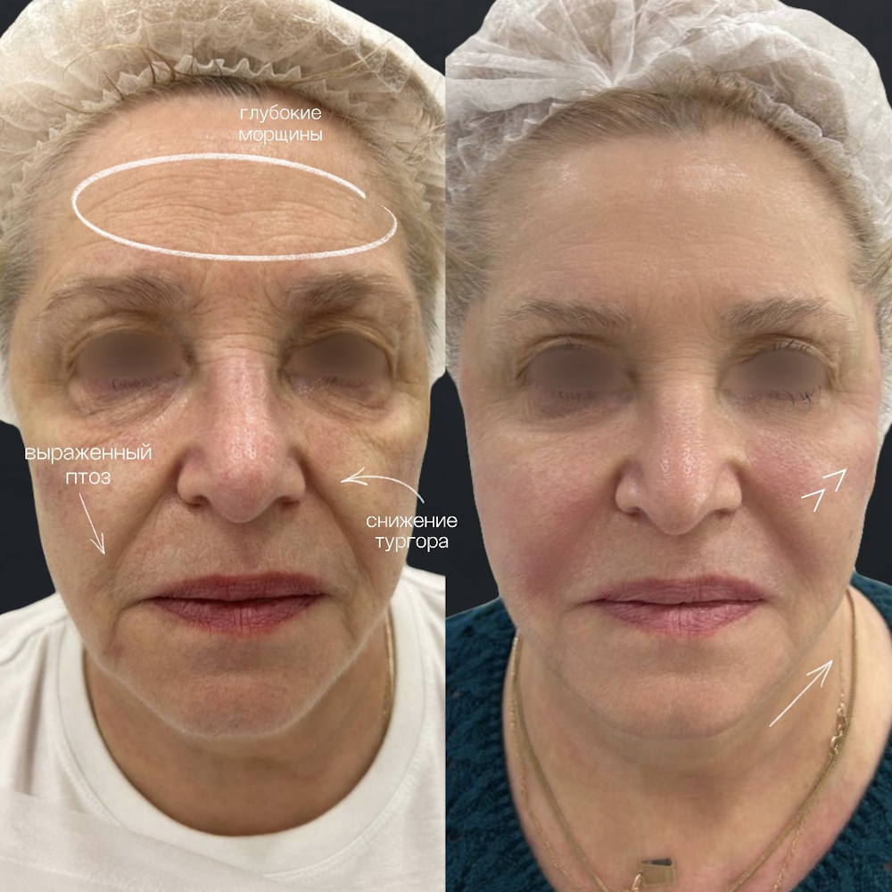 Комплексное преображение