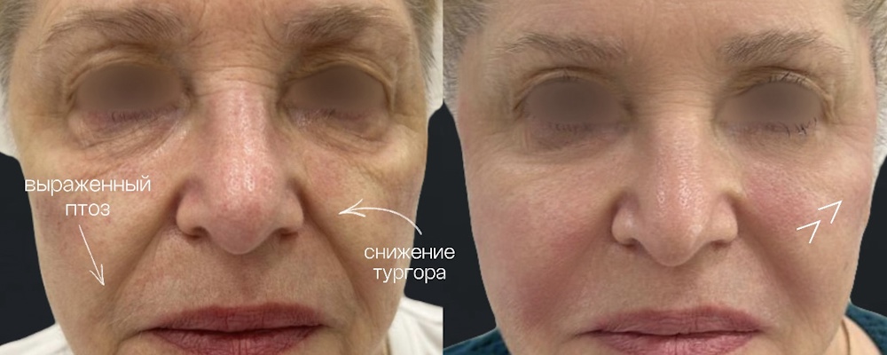 Комплексное преображение