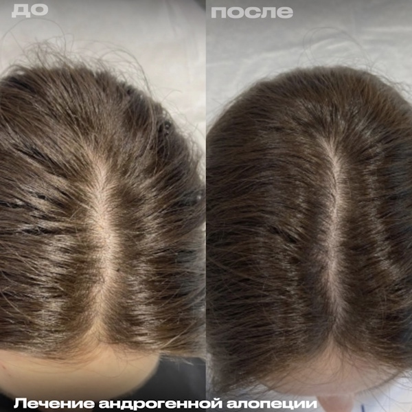 Кунашева Елена Арсеновна