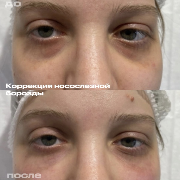 Кунашева Елена Арсеновна