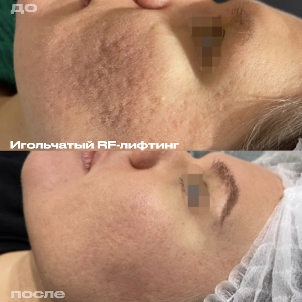 Кунашева Елена Арсеновна