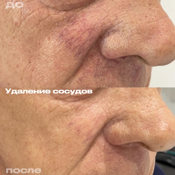 Кунашева Елена Арсеновна