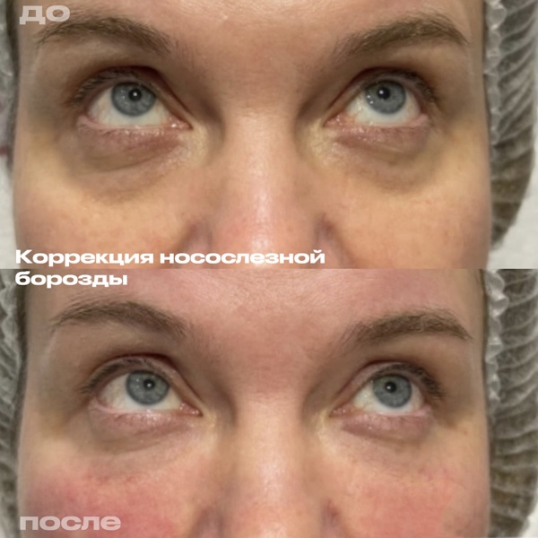 Кунашева Елена Арсеновна