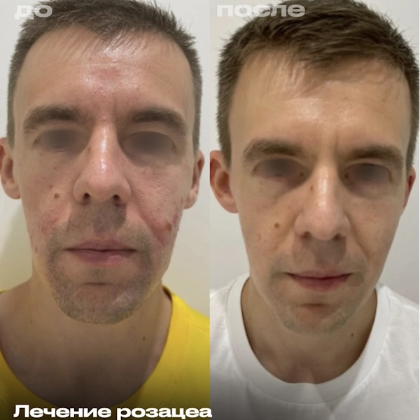 Кунашева Елена Арсеновна
