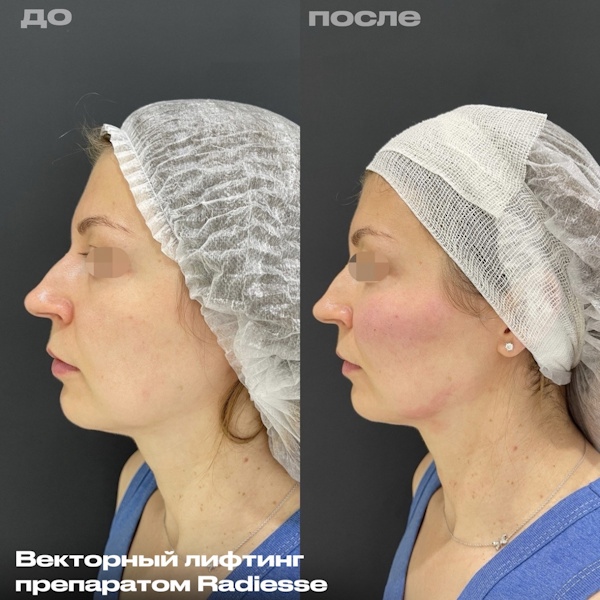 Кунашева Елена Арсеновна