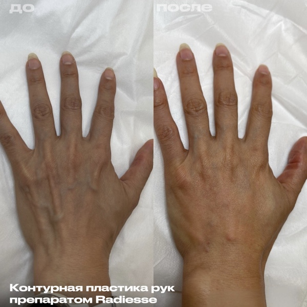 Кунашева Елена Арсеновна