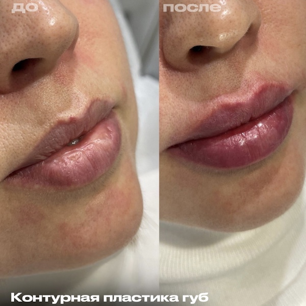 Кунашева Елена Арсеновна