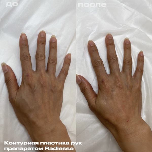 Кунашева Елена Арсеновна