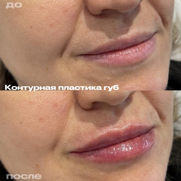 Кунашева Елена Арсеновна