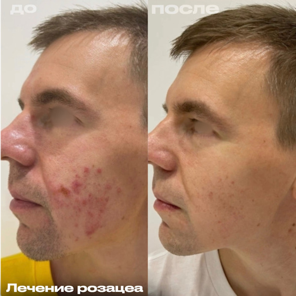 Кунашева Елена Арсеновна