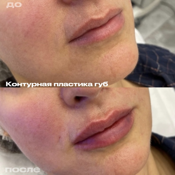 Кунашева Елена Арсеновна