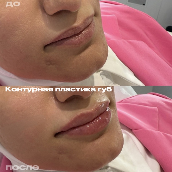 Кунашева Елена Арсеновна