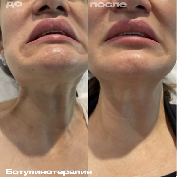 Кунашева Елена Арсеновна
