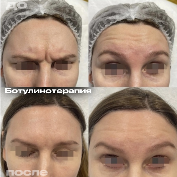 Кунашева Елена Арсеновна