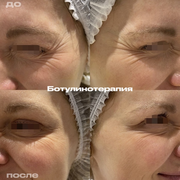 Кунашева Елена Арсеновна
