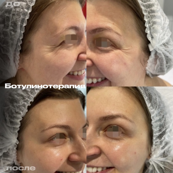 Кунашева Елена Арсеновна