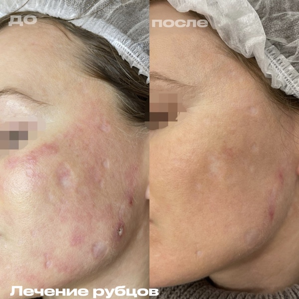 Кунашева Елена Арсеновна