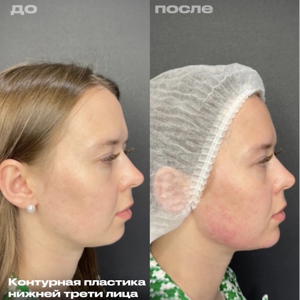 Кунашева Елена Арсеновна