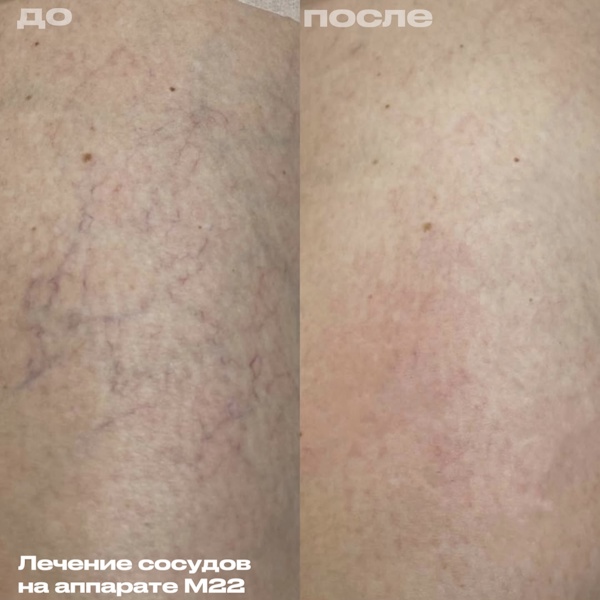 Лежнева Дина Алексеевна