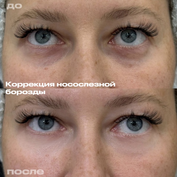 Лежнева Дина Алексеевна