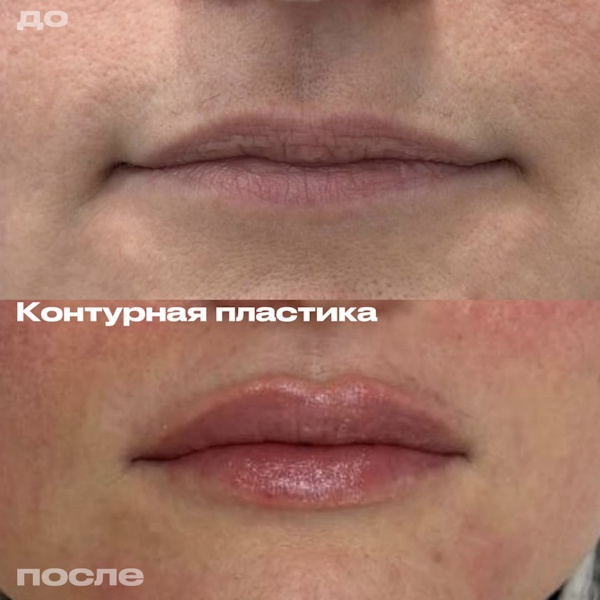 Лежнева Дина Алексеевна
