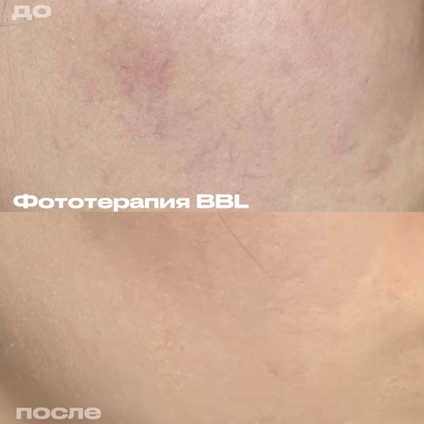 Лежнева Дина Алексеевна