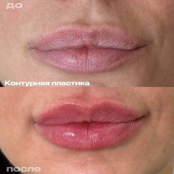 Лежнева Дина Алексеевна