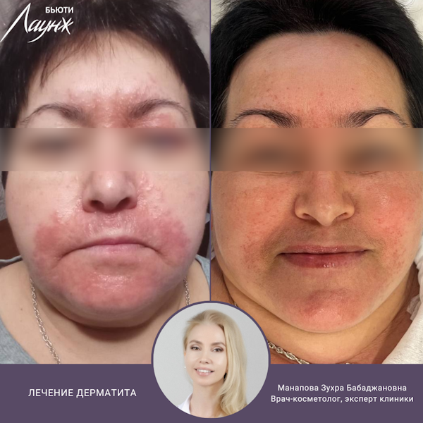 Манапова Зухра Бабаджановна