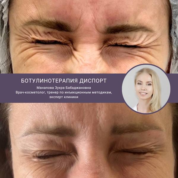 Манапова Зухра Бабаджановна