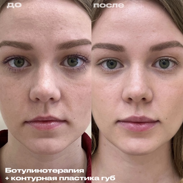 Шоно Анна Анатольевна
