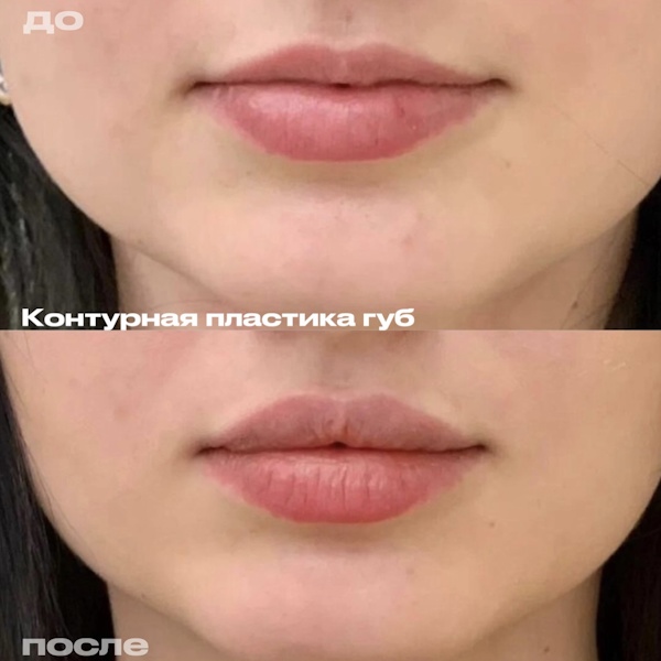 Шоно Анна Анатольевна